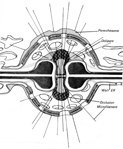 Dolipore septa with perforate parenthesome