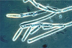 Colony bearing unispored sporangia of Genistelloides helicoides