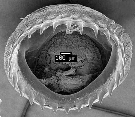 SEM_photograph_of_a_large_dactylus_sucker.