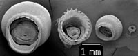 SEM_photograph_comparing_sucker_sizes.